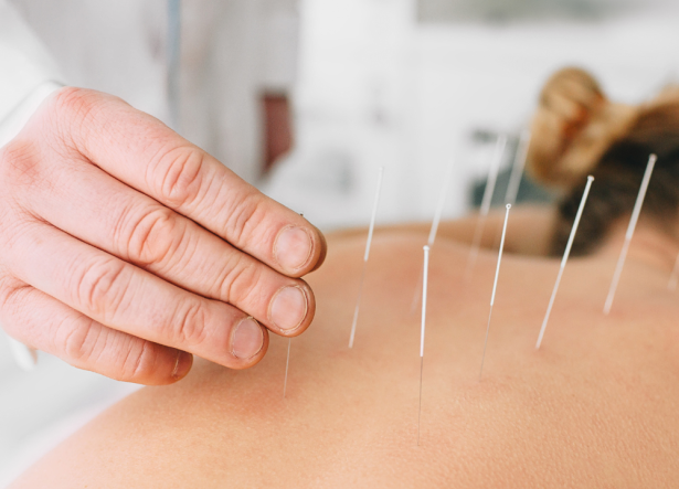 akpupunklturCe (1000 x 720 px)